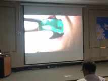 Implant and GBR course in Hamedan_27